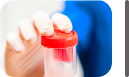 Semen Testing at 3 months